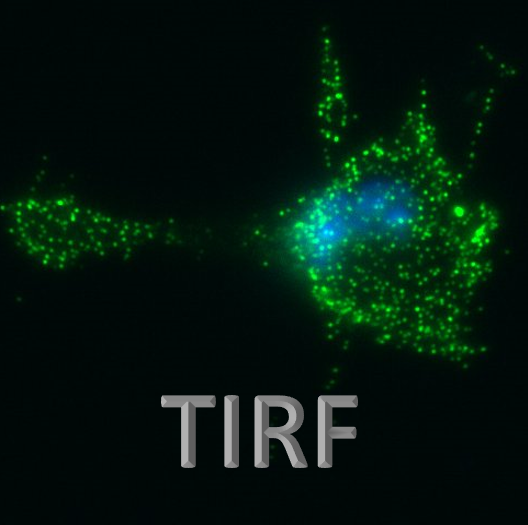 TIRF microscopy