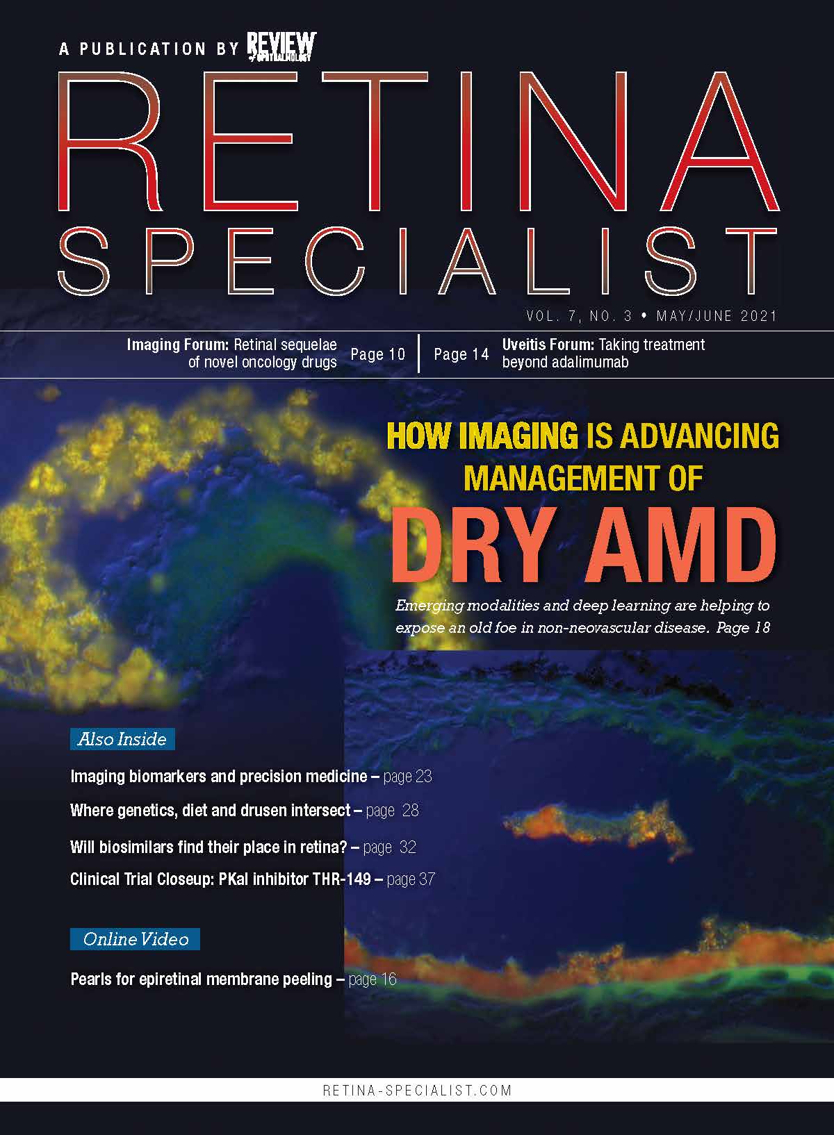 Dr.  Johanna Seddon's research was covered in June 2021 edition of Retina Specialist newsletter
