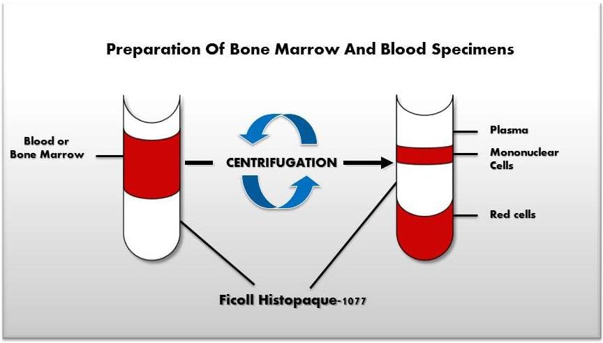 Preparation_of_BM_and_Blood_specimens.jpg