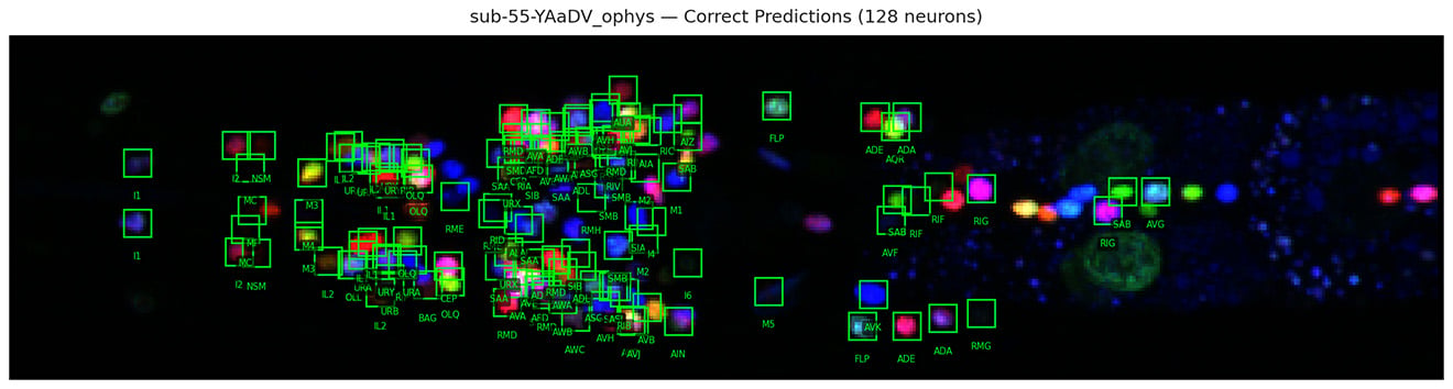 A protype of the AI algorithm identifies each C. elegans neuron in the image (green box) and labels it based on its position in the animal and neighboring cells.