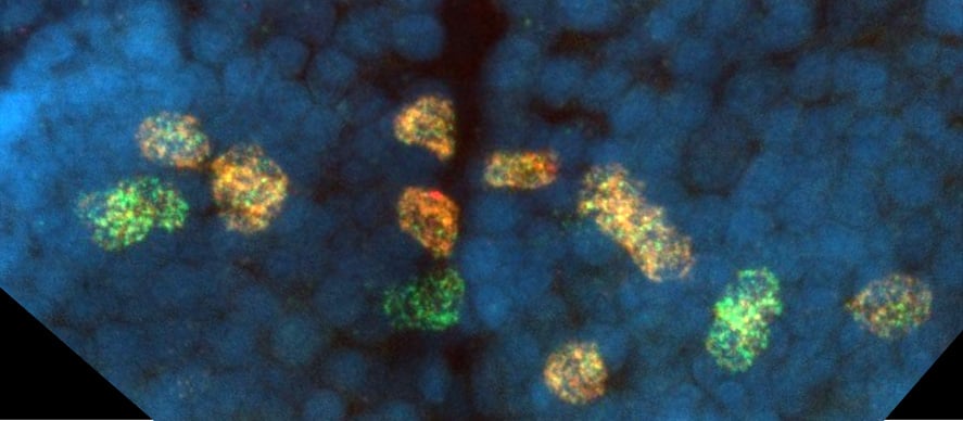Per (orange) and Cry2 (green) expression in the brain of P. hawaiensis. 