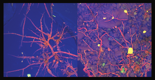 UMass Chan scientists use transparent soil system to study the interactions of bacteria and fungi