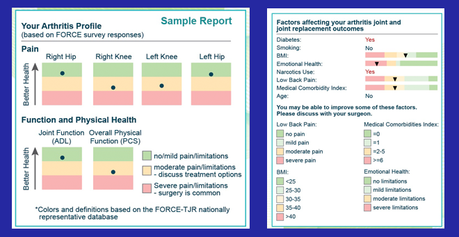 Screen shots of the A.S.K. tool, which compares an individual’s information with nationwide population data to help patients and doctors decide if and when to proceed with total joint replacement surgery.