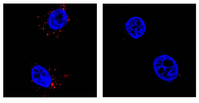 Zika virus infecting cells: Zika virus (red) infects cultured human cells (blue, left panel). Zika virus replication is inhibited (right panel), when UMMS researchers lowered the EMC1 protein’s levels in the human cells.