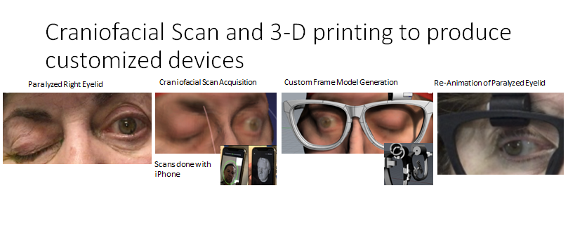 Craniofacial Scan Prototype 
