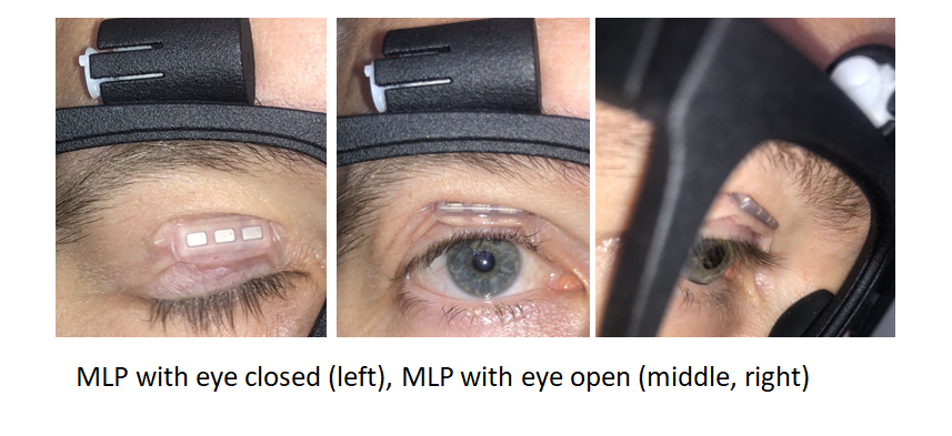 Eye stages from open to closed