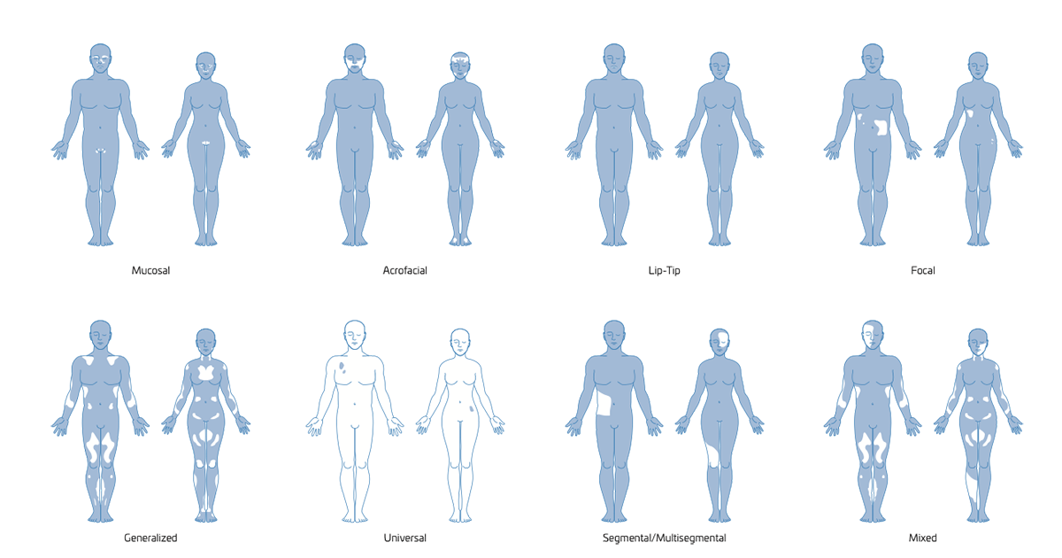 EZ Front and Hind Patterns (no clips)