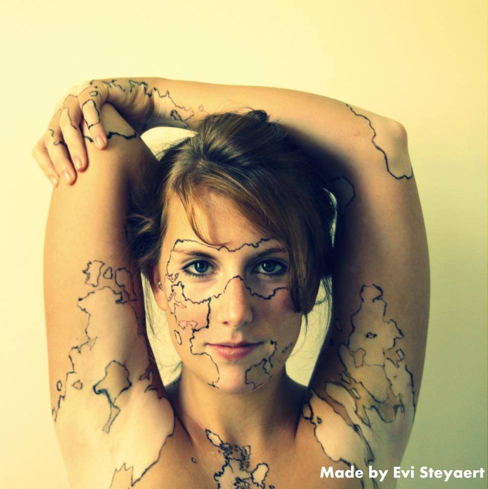 Speaking of Vitiligo Should someone with vitiligo get a Speaking of Vitiligo Should someone with vitiligo get a