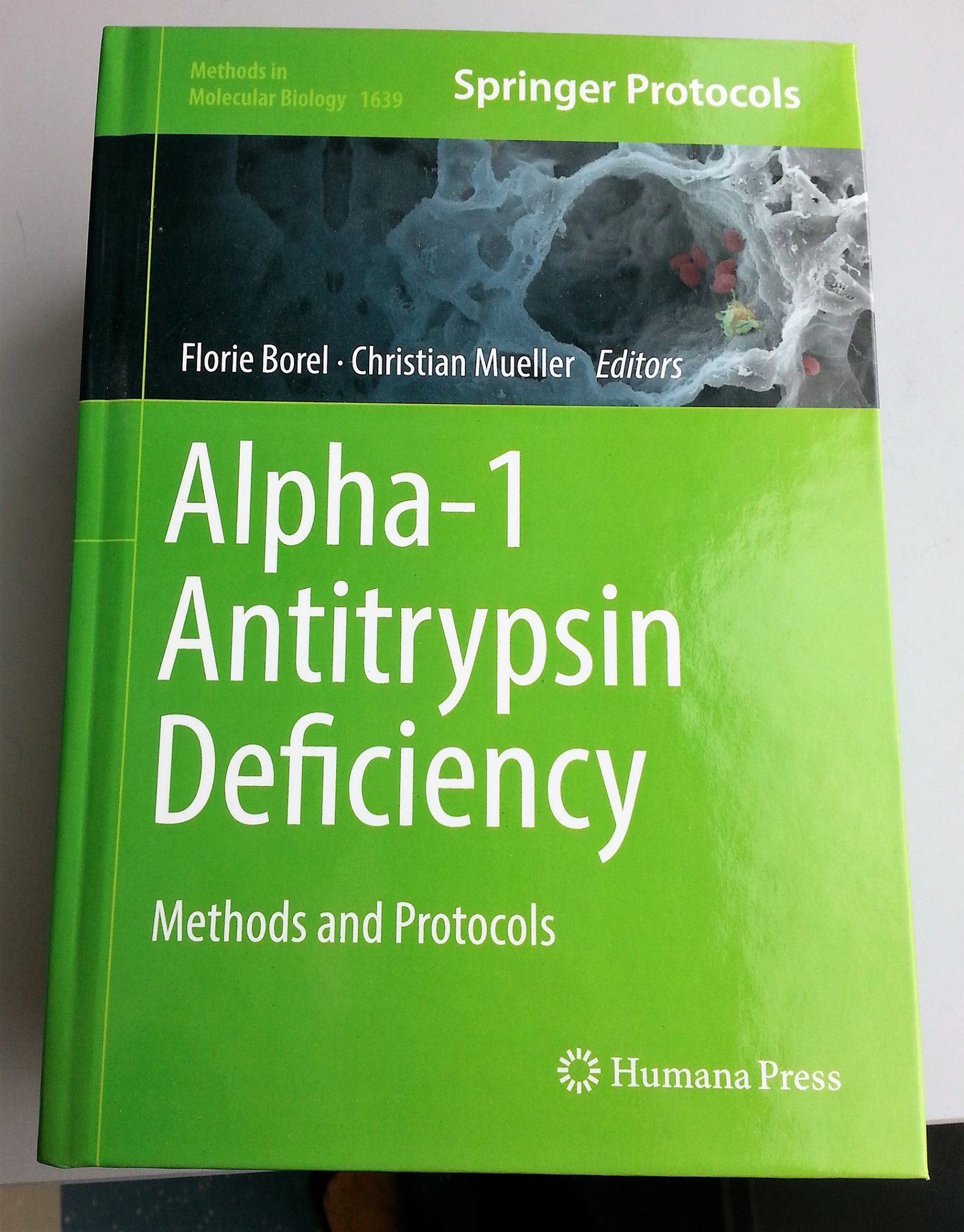Alpha-1 antitrypsin deficiency methods protocols Springer Nature Borel Mueller