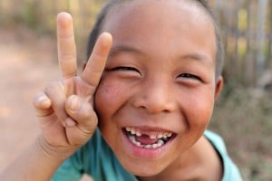 Happy child with missing front tooth