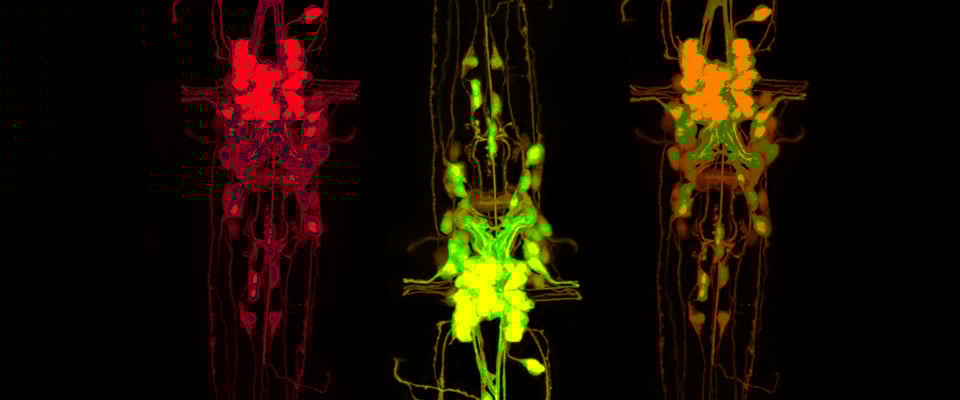 cholinergic neurons